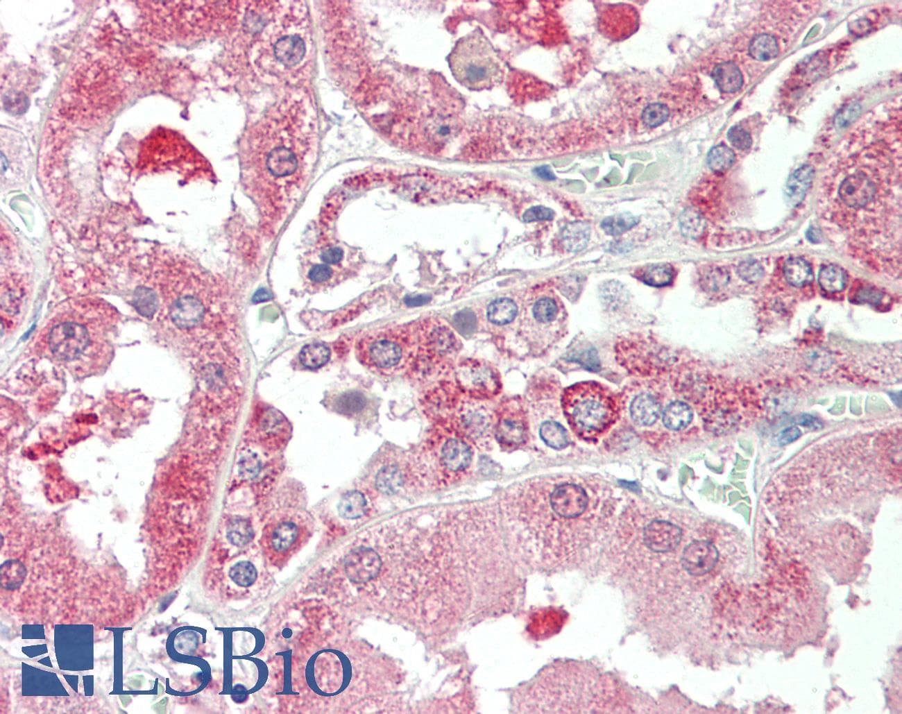 IHC-plus™ KIF6 Antibody (aa177-190)