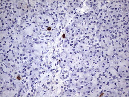 Monoclonal Mouse anti-Human MAP1LC3A / LC3A Antibody (clone OTI10H6, IHC, WB)