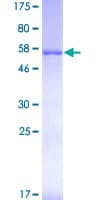 Human RAD51L3 / RAD51D Protein (Recombinant GST)