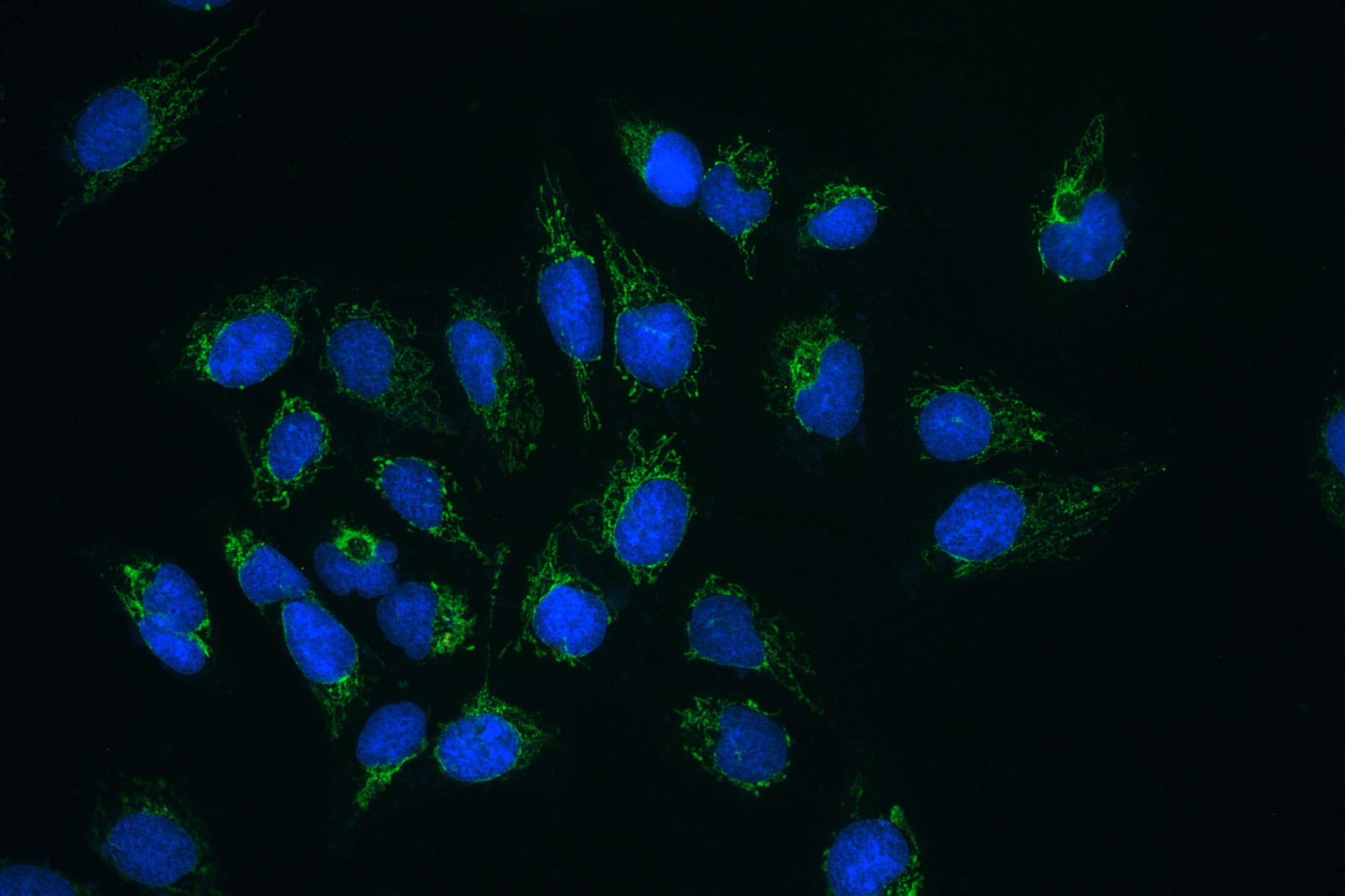 CLPX Antibody