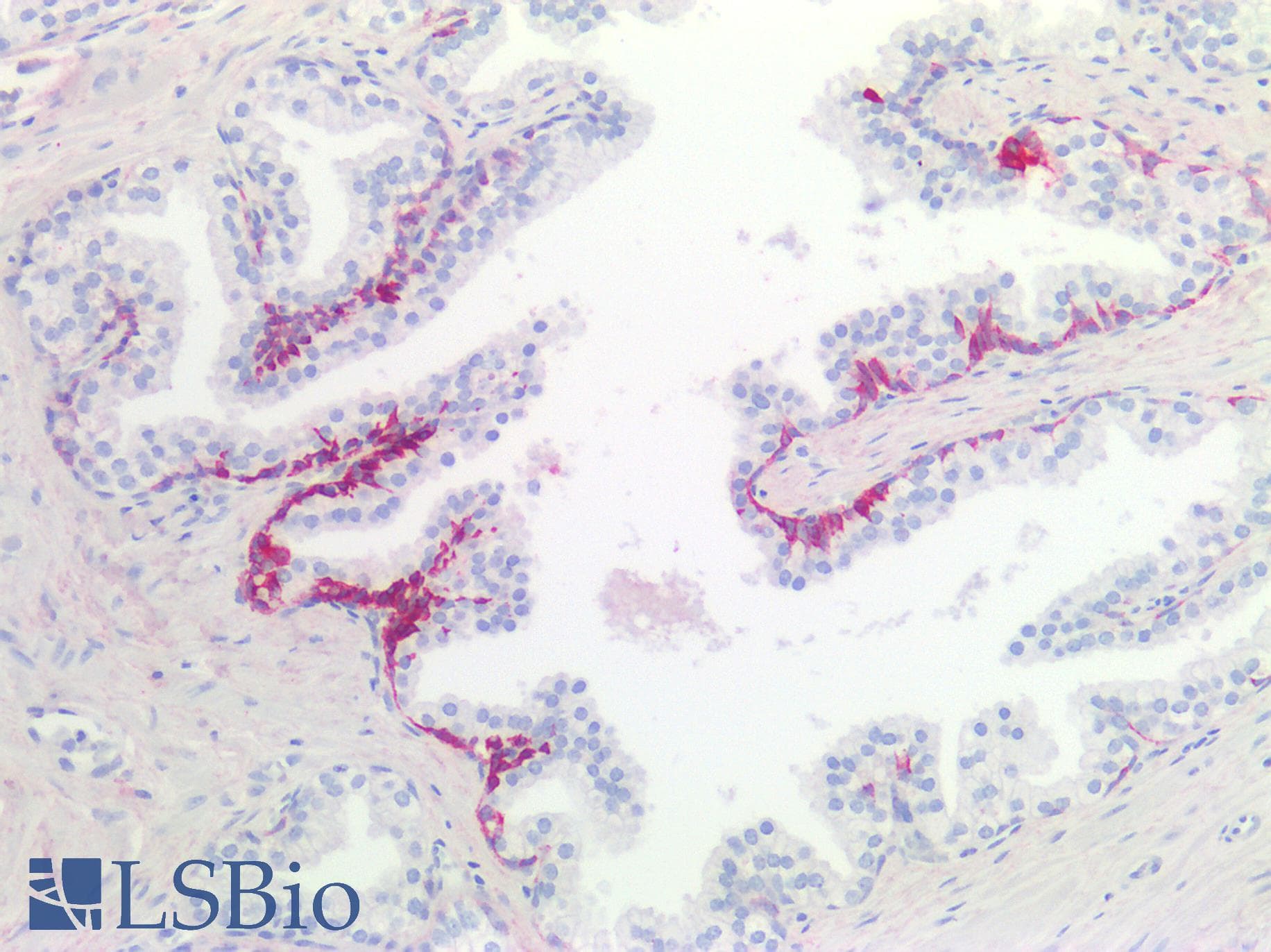 PathPlus™ Monoclonal Mouse anti-Human KRT7 / CK7 / Cytokeratin 7 Antibody (IHC, WB)