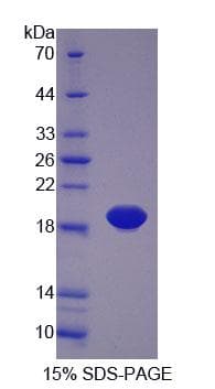 Rat PLTP Protein (Recombinant His-T7, N-terminus)