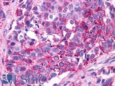 PathPlus™ Polyclonal Rabbit anti-Human PTGER3 / EP3 Antibody (N-Terminus, IHC)