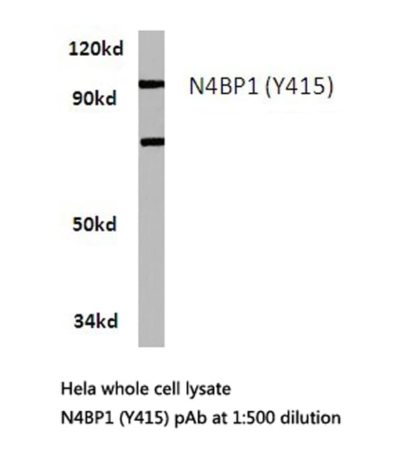 Polyclonal Rabbit anti-Human N4BP1 Antibody (Tyr415, IHC, WB)