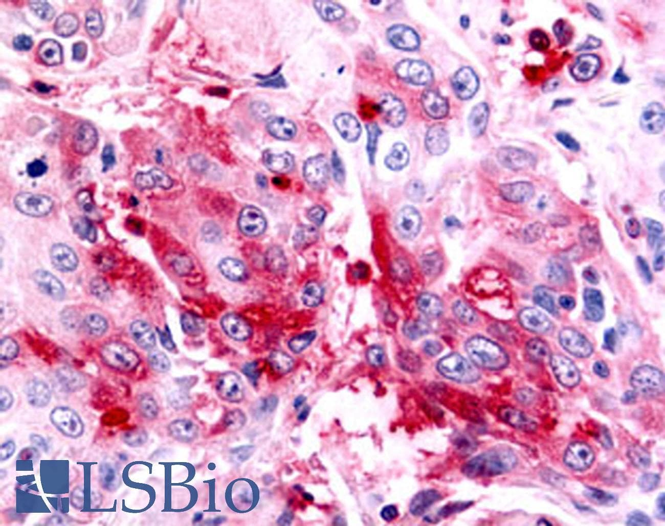 PathPlus™ NR5A2 / LRH-1 Antibody (C-Terminus)