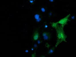 PIP4K2A / PIPK Antibody (clone OTI1B2)
