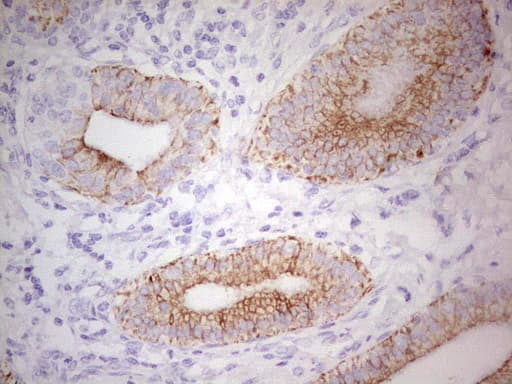 ABCB1 / MDR1 / P Glycoprotein Antibody (aa995-1280, clone OTI10H3, Carrier-free)