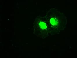 PLK1 / PLK-1 Antibody (clone OTI8C12)