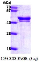 Human DFFA / ICAD / DFF45 Protein (Recombinant His)