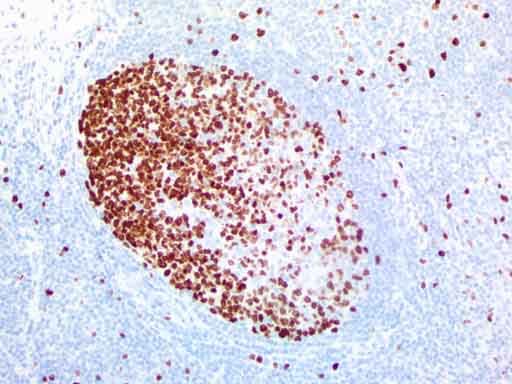 MKI67 / Ki67 Antibody (aa1160-1493, clone UMAB107, Carrier-free)