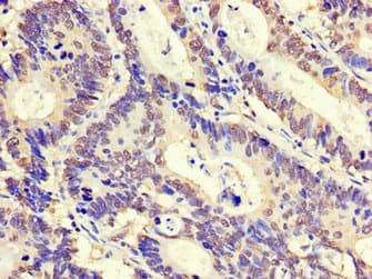 ZNF844 Antibody