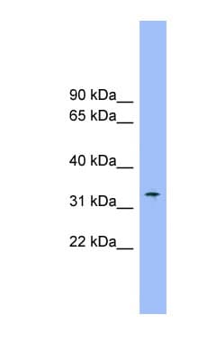 SLC25A1 / SEA Antibody (aa215-264)
