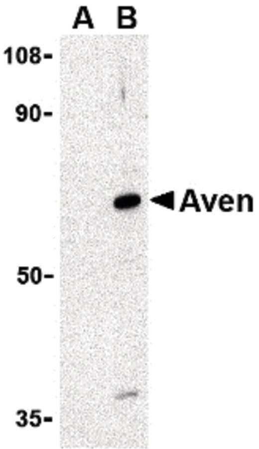 IHC-plus™ AVEN / PDCD12 Antibody