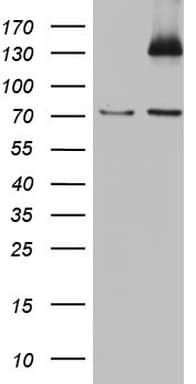 PMEL / SILV / gp100 Antibody (aa25-467, clone OTI6D5)