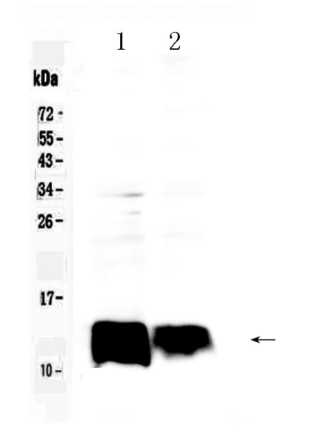 Polyclonal Rabbit anti-Human B2M / Beta 2 Microglobulin Antibody (IHC, WB)
