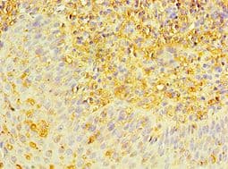 MAP2K3 / MEK3 / MKK3 Antibody (aa1-170)