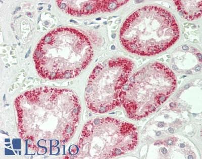 IFN Beta / Interferon Beta Antibody (aa22-187)
