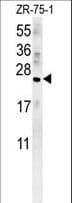 Polyclonal Rabbit anti-Human AVP / ADH / Vasopressin Antibody (aa102-129, IHC, IF, WB)