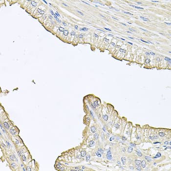 FABP12 Antibody