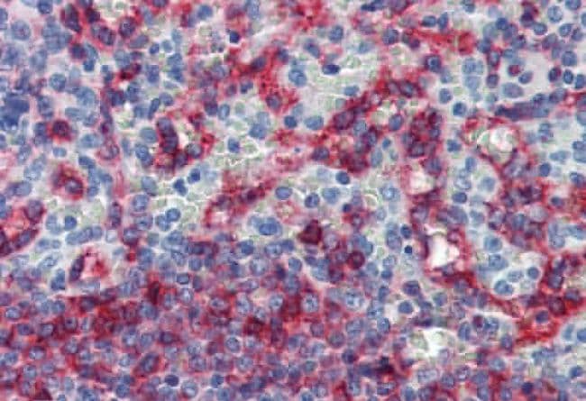 HLA-E Antibody (clone MEM-E/06)