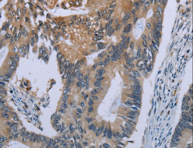C/EBP Delta / CEBPD Antibody