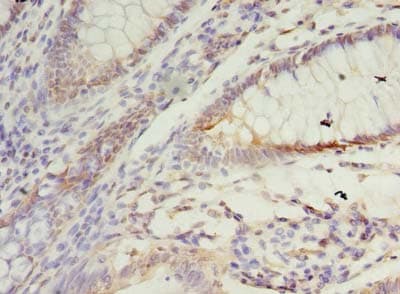 Polyclonal Rabbit anti-Human SSR3 / TRAP-Gamma Antibody (IHC, WB)