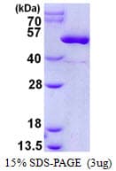 Human CKMT2 Protein (Recombinant His)
