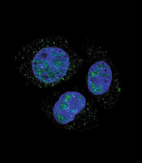 RB1 / Retinoblastoma / RB Antibody (phospho-Ser811)