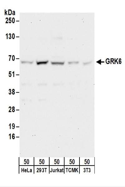 GRK6 Antibody (aa526-576)