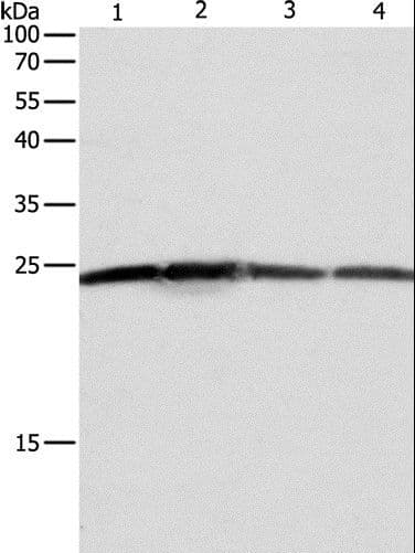 BAK1 / BAK Antibody
