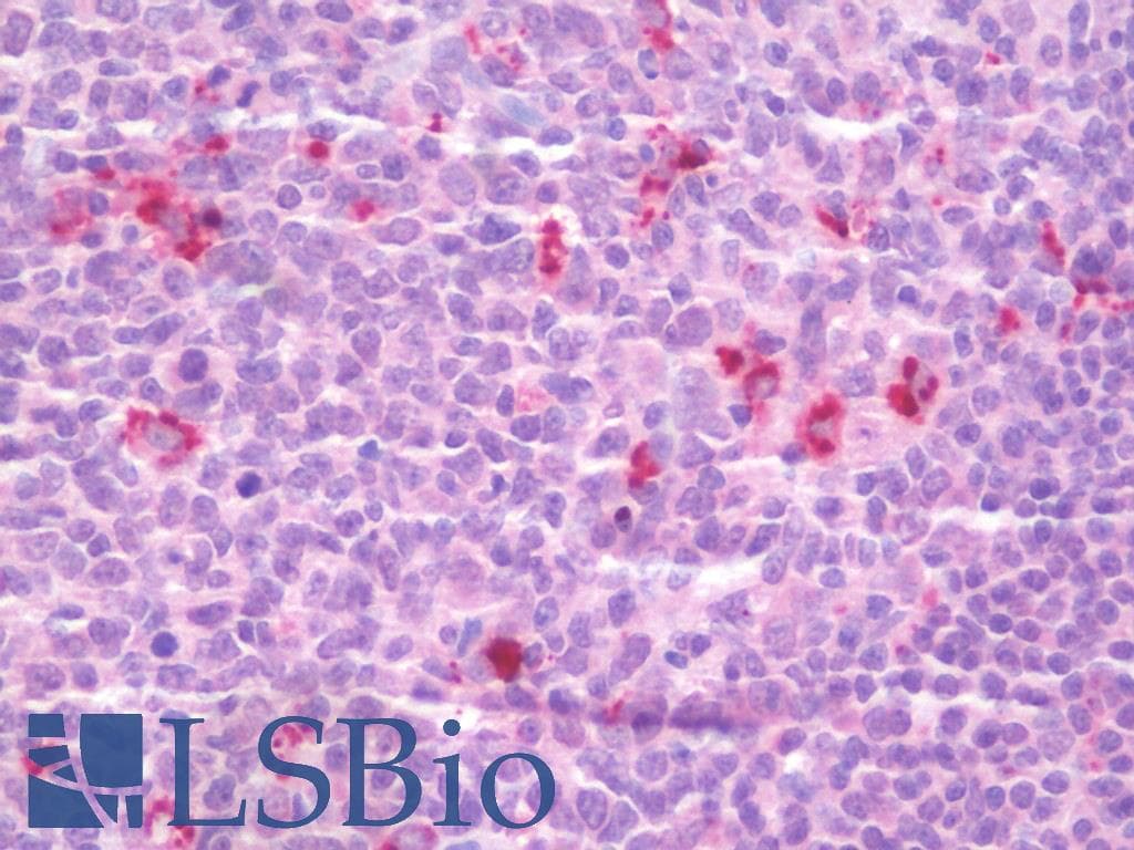 IHC-plus™ MDM4 / MDMX Antibody (clone 4G5)
