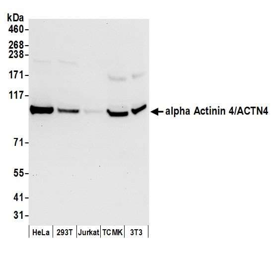 ACTN4 Antibody (aa1-50)