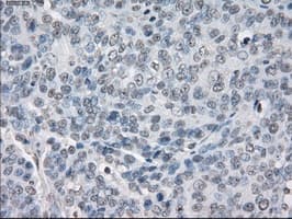 PPP5C Antibody (clone OTI5G5)