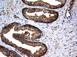 NME1 / NM23 Antibody (clone OTI2H10)