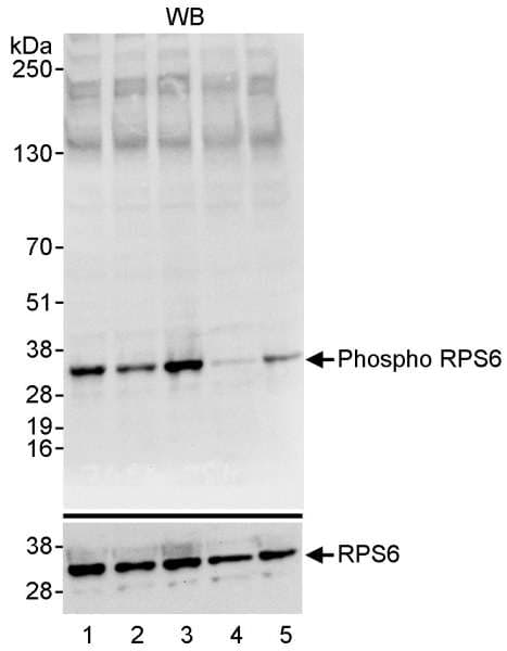 RPS6 / Ribosomal Protein S6 Antibody (phospho-Ser235/236)