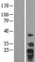 TMEM147 Protein (Over-Expression Lysate Myc-DDK (Flag))