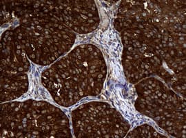 NME1 / NM23 Antibody (clone OTI3F2, Carrier-free)