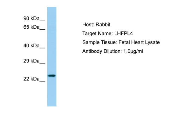 LHFPL4 Antibody (aa137-186)