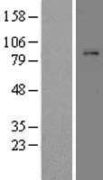 Human PLG / Plasmin / Plasminogen Protein (Over-Expression Lysate Myc-DDK (Flag))