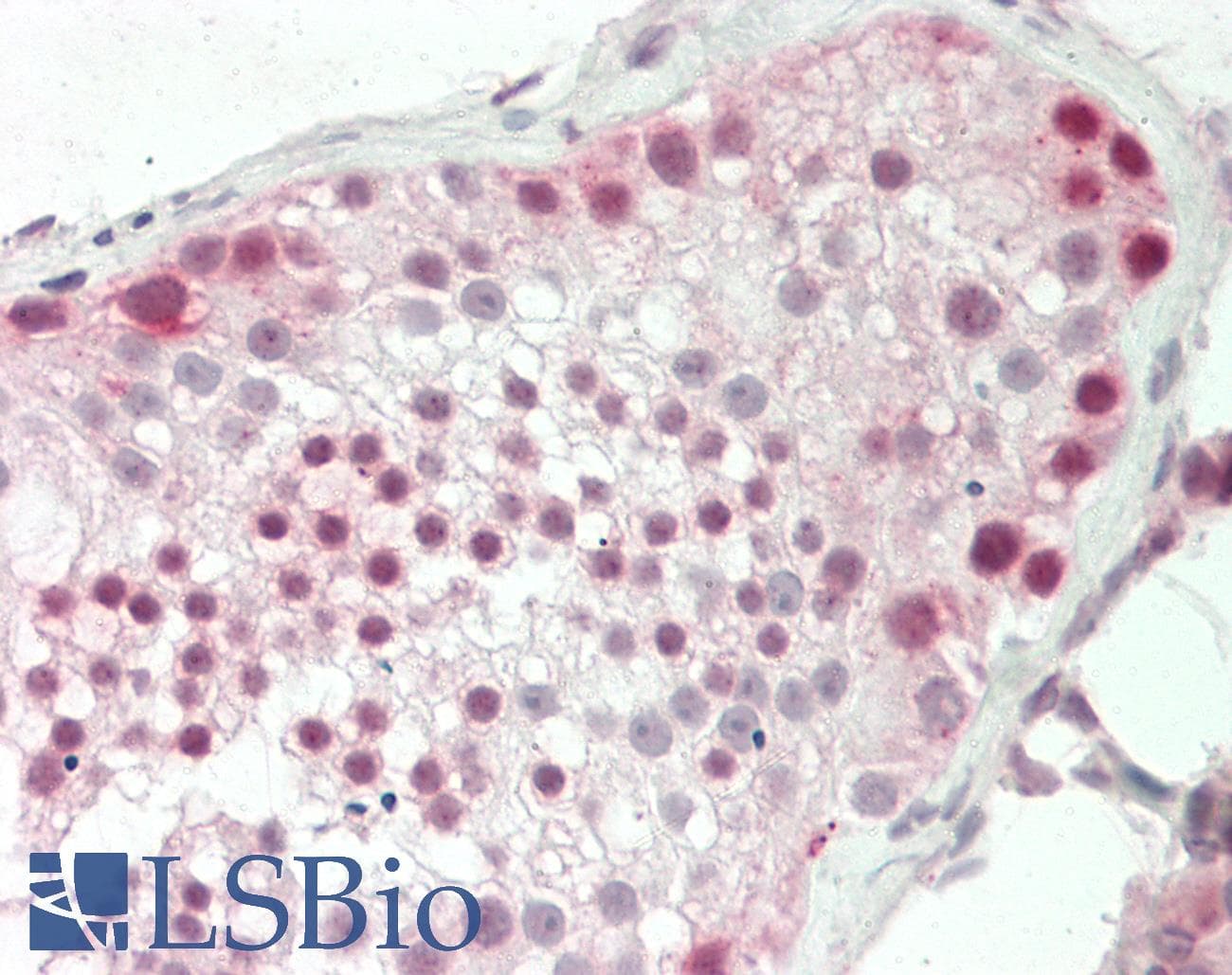 IHC-plus™ PRMT9 / PRMT10 Antibody (aa1-50)