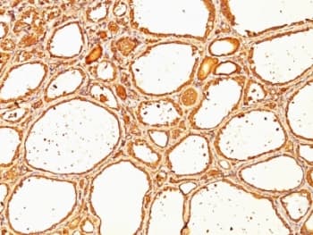 TG / Thyroglobulin Antibody (clone SPM517)
