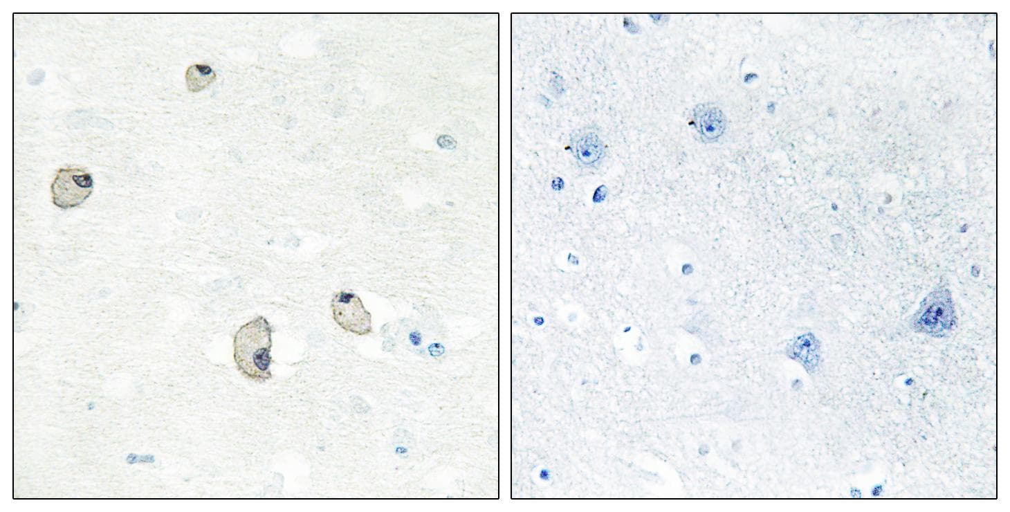 Polyclonal Rabbit anti-Human CDH22 / Cadherin 22 Antibody (IHC, IF, WB)