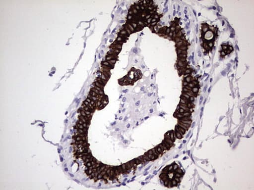 Monoclonal Mouse anti-Human KRT19 / CK19 / Cytokeratin 19 Antibody (clone OTI1F5, aa240-390, IHC, WB)