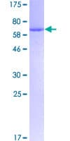 Human CSNK2A2 Protein (Recombinant GST)