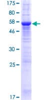 Human GPN2 Protein (Recombinant GST)