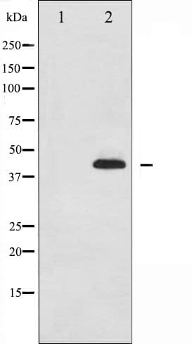 Polyclonal Rabbit anti-Human MAPK14 / p38 Antibody (phospho-Tyr323, IHC, IF, WB)