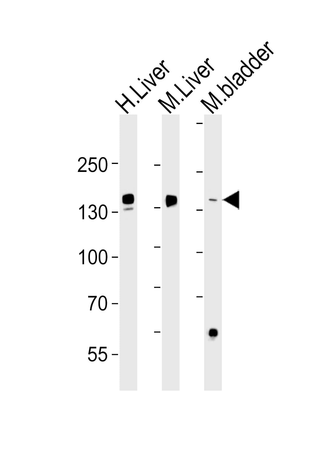 Monoclonal Mouse anti-Human FGA / Fibrinogen Alpha Antibody (aa420-448, WB)