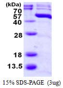 Human MAPK11 / SAPK2 / p38 Beta Protein (Recombinant His)