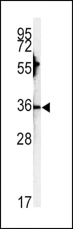 IHC-plus™ Polyclonal Rabbit anti-Human CA3 / Carbonic Anhydrase III Antibody (aa17-46, IHC, WB)