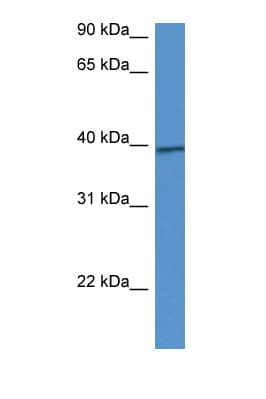 Polyclonal Rabbit anti-Mouse CALHM1 Antibody (aa295-344, WB)